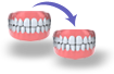 Tandprothese in reserve